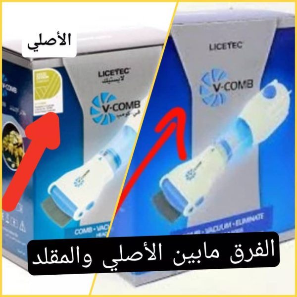 V-Comb الأصلي – الحل النهائي ضد القمل والصيبان – Image 2